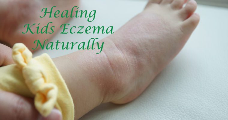 7 Steps in Healing Kids Eczema Naturally
